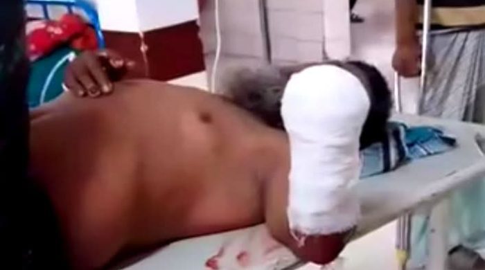 ব্রাহ্মণবাড়িয়ার নবীনগরে ভাতিজার দায়ের কুপে চাচা রফিকুল ইসলামের বাম হাতের কব্জি বিচ্ছিন্ন হয়ে গে