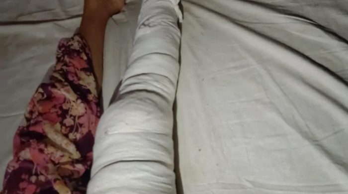 ব্রাহ্মণবাড়িয়ায় সাংবাদিকের বাড়িতে সন্ত্রাসী হামলা: বোমা বিস্ফোরণ, ভাঙচুর, লুটপাট ও বৃদ্ধা মায়ের হাত-পা ভেঙে দিয়েছে হামলাকারীরা